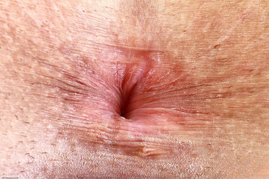 Naughty Ginger Keely Rose Teases Exposed Holes and Luscious Curves - 21