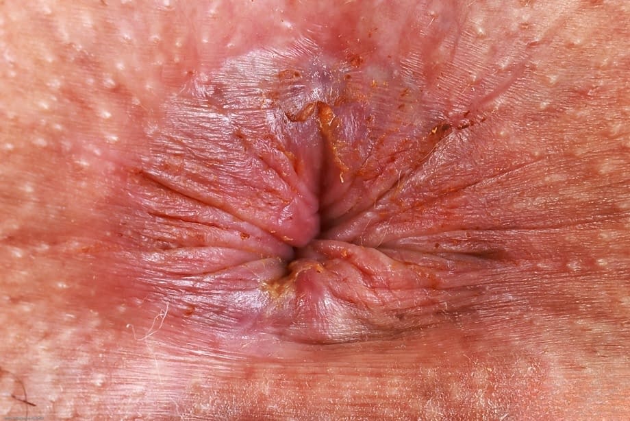 La douce Sophia nue écarte les jambes pour exposer sa chatte ruisselante, dévoilant ses replis roses après un strip-tease sensuel - 21