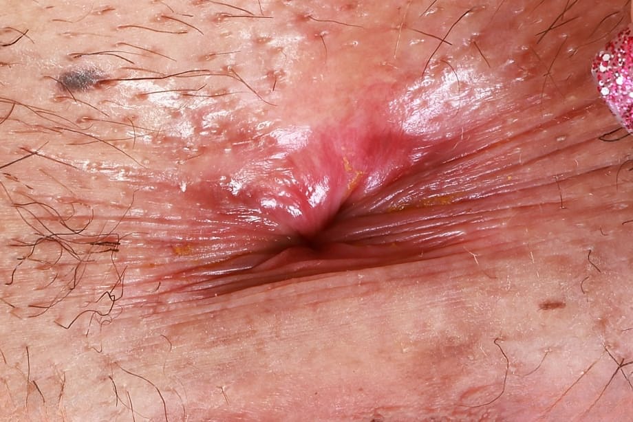 Scarlett Page loves teasing her gaping holes close-up in an intimate display - 21
