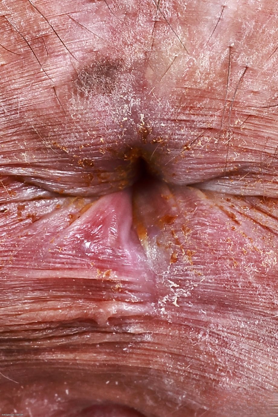 Teen girl of color Ameena Green gets naked for a close-up of her vagina